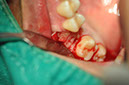 %_tempFileNameImplant%20108b7%