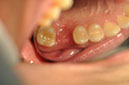 %_tempFileNameImplant%20108b9%