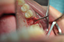 %_tempFileNameImplant%20108c1%