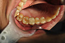 %_tempFileNameImplant%20108c5%