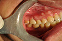 %_tempFileNameImplant%20108c6%