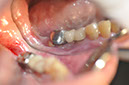 %_tempFileNameImplant%20109a1%