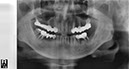 %_tempFileNameImplant%20109a2%