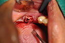 %_tempFileNameImplant%20109a3%