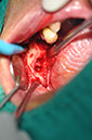 %_tempFileNameImplant%20109a5%