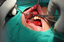 %_tempFileNameImplant%20109b5%