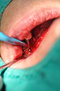 %_tempFileNameImplant%20109b6%