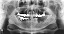 %_tempFileNameImplant%20109c1%