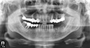 %_tempFileNameImplant%20109c2%