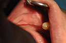 %_tempFileNameImplant%20109c3%