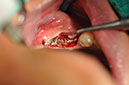 %_tempFileNameImplant%20109c4%