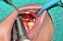 %_tempFileNameImplant%20109d1%