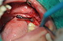 %_tempFileNameImplant%20109d2%
