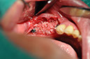%_tempFileNameImplant%20109d3%