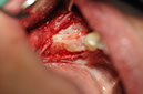 %_tempFileNameImplant%20109d4%
