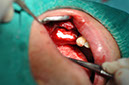 %_tempFileNameImplant%20109d5%