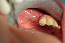 %_tempFileNameImplant%20109d6%