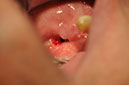 %_tempFileNameImplant%20109e1%