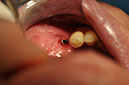 %_tempFileNameImplant%20109e2%