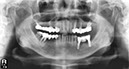 %_tempFileNameImplant%20109e7%
