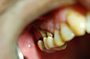 %_tempFileNameImplant%2010a1%