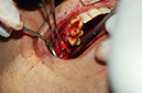 %_tempFileNameImplant%2010b12%
