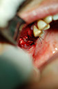 %_tempFileNameImplant%2010c1%