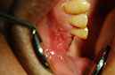 %_tempFileNameImplant%2010d1%