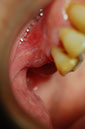%_tempFileNameImplant%2010d2%