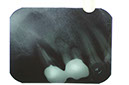 %_tempFileNameImplant%2010e1%