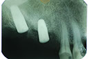 %_tempFileNameImplant%2010e6%