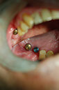 %_tempFileNameImplant%2010f1%