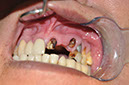 %_tempFileNameImplant%20110a1%