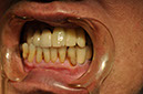 %_tempFileNameImplant%20110d1%
