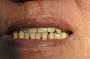%_tempFileNameImplant%20110d2%