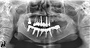 %_tempFileNameImplant%20111d2%