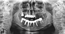 %_tempFileNameImplant%20111d3%