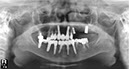 %_tempFileNameImplant%20111d5%