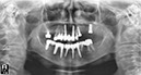 %_tempFileNameImplant%20111d6%
