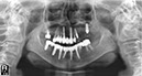 %_tempFileNameImplant%20111d7%