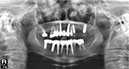 %_tempFileNameImplant%20111d8%