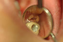%_tempFileNameImplant%20113a1%