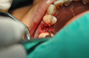 %_tempFileNameImplant%20113a5%