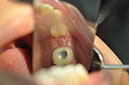%_tempFileNameImplant%20113a8%