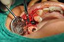 %_tempFileNameImplant%20113b9%