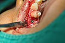 %_tempFileNameImplant%20113c1%