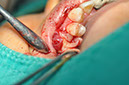 %_tempFileNameImplant%20113c3%