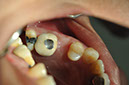 %_tempFileNameImplant%20113c5%