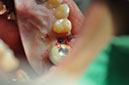 %_tempFileNameImplant%20113c6%