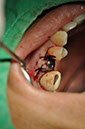 %_tempFileNameImplant%20113c7%